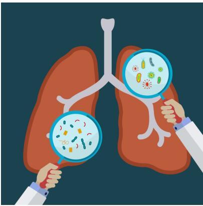 NK細胞免疫療法治療肺癌最新研究   
