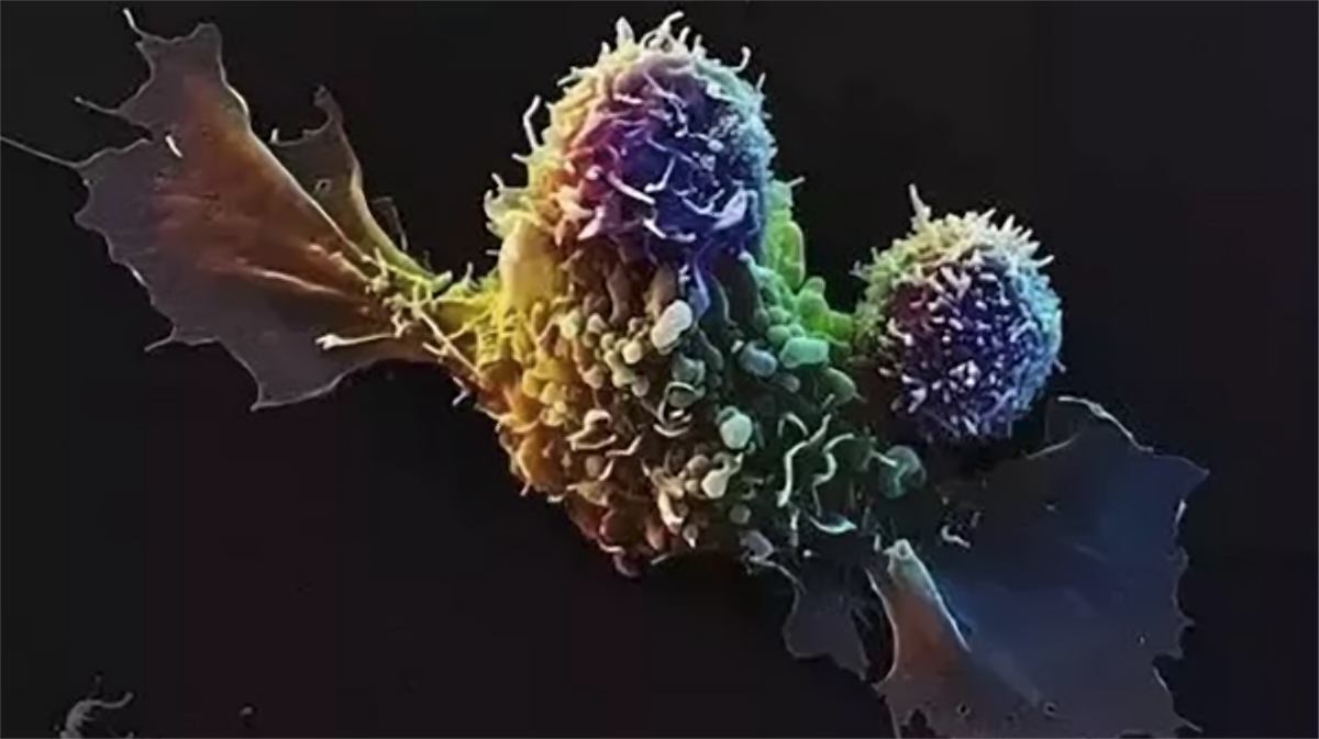 NK細胞免疫療法現狀很樂觀，有望治愈更多的癌癥患者