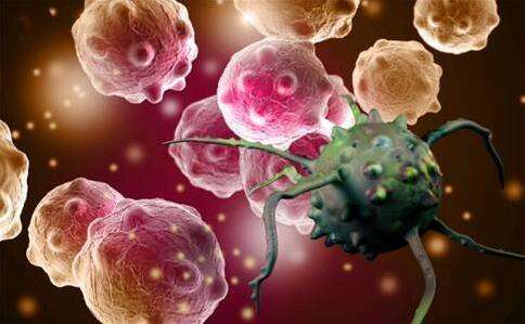 NK細胞療法-癌癥患者的新選擇