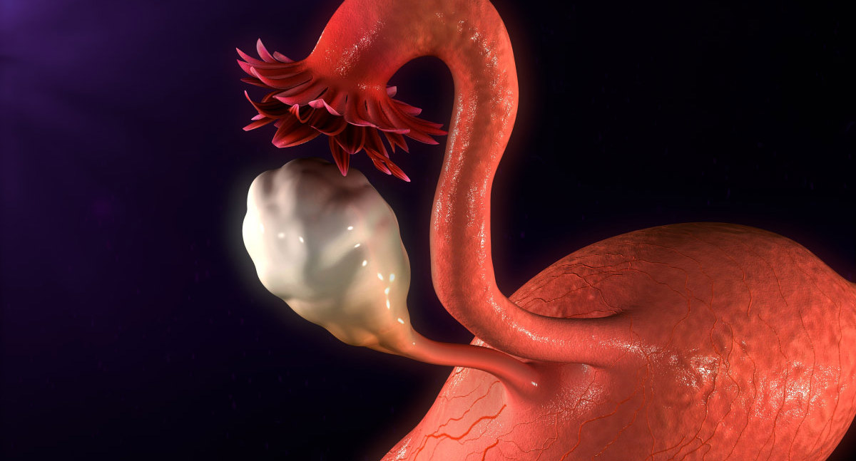 干細胞治療卵巢早衰，患者順利分娩健康寶寶