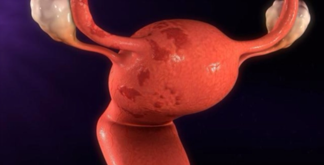 薄型子宮內膜